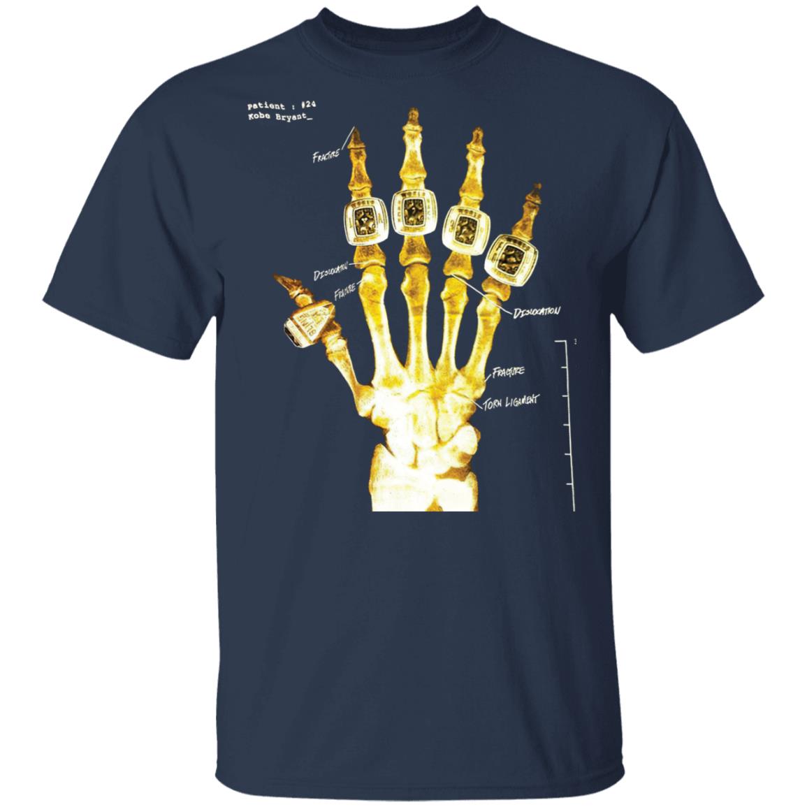 Kobe 5 Rings Hand X-Ray
