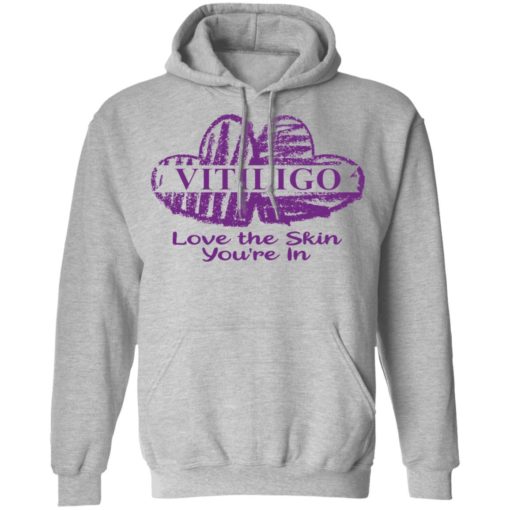 Vitiligo love the skin you’re in shirt